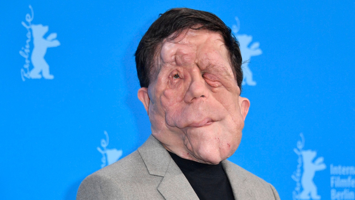 Adam Pearson Will Lead A Fresh Movie Take On The Elephant Man