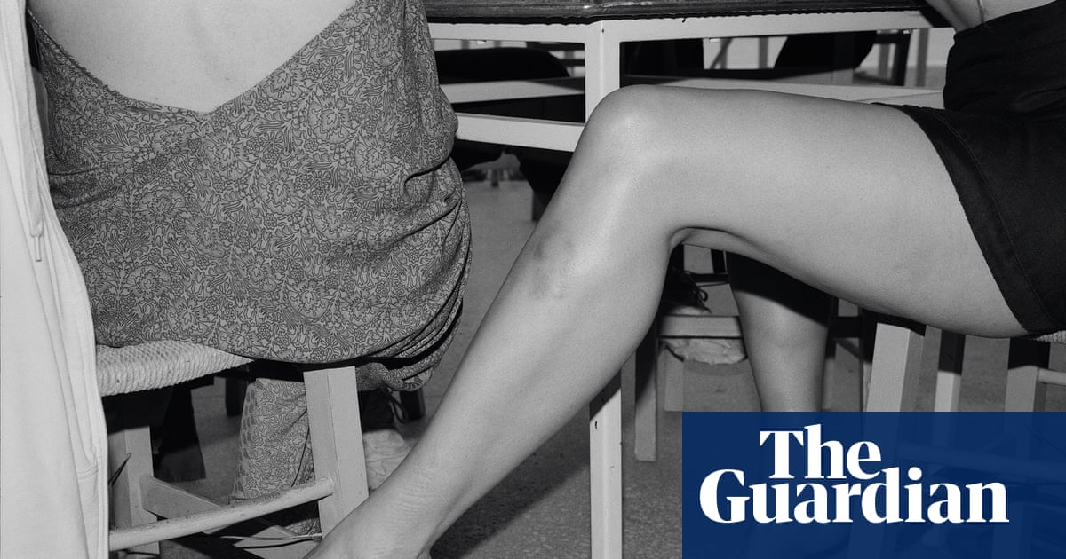 ‘Arms and legs are very expressive, especially with bruises’: the absurdist photography of Yorgos Lanthimos | Photography ‘Arms and legs are very expressive, especially with bruises’: the absurdist photography of Yorgos Lanthimos | Photography